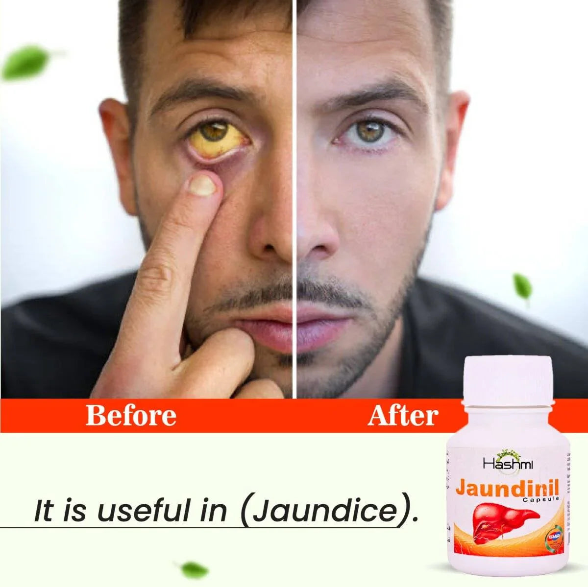 Hashmi Jaundinil 20 Capsule